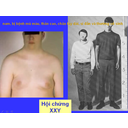 Show  Image