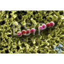 Show Phế cầu-Pneumococcus Image