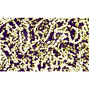 Show Liên cầu-Streptococcus Image